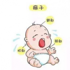 夏季小孩子怎么避免长痱子