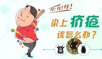 得了疥疮怎么治疗